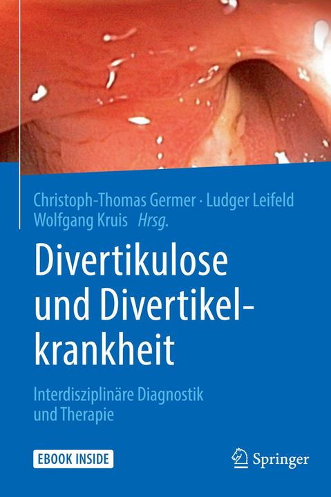 Produktbild Divertikulose und Divertikelkrankheit (Deutsch, Christoph-Thomas Germer, Ludger Leifeld, Wolfgang Kruis, 2017)