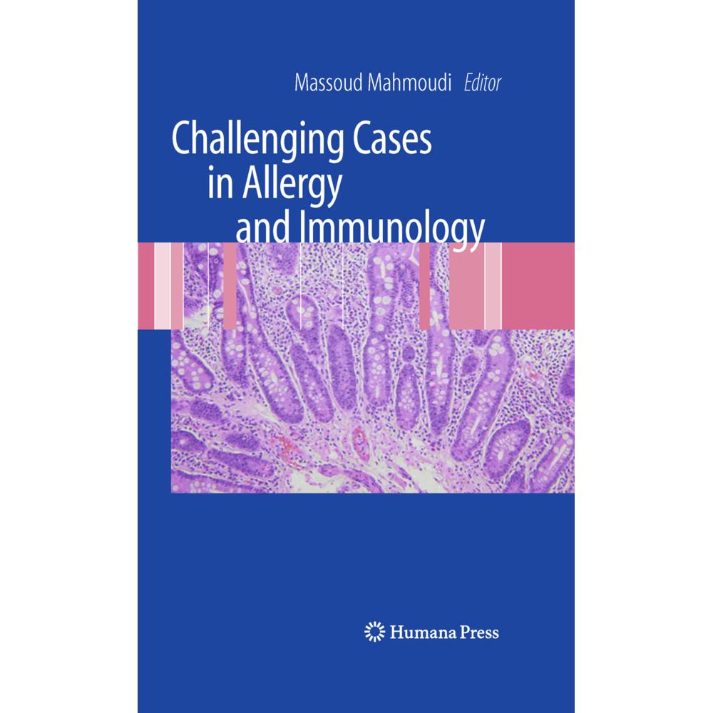Challenging Cases in Allergy and Immunology, Fachbücher von Massoud Mahmoudi