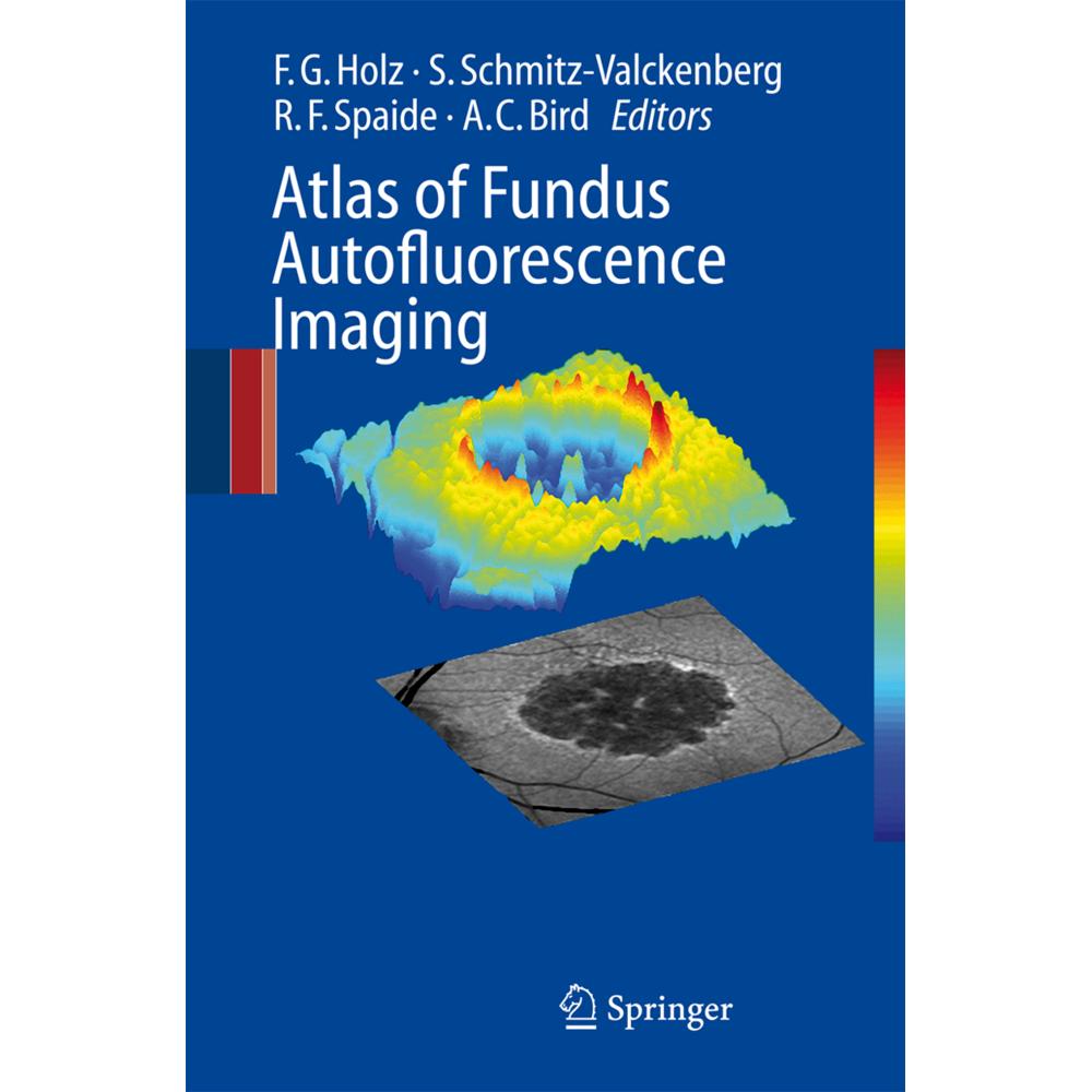 Atlas of Fundus Autofluorescence Imaging, Fachbücher von Alan C. Bird, Richard F. Spaide, Steffen Schmitz-Valckenberg, F...