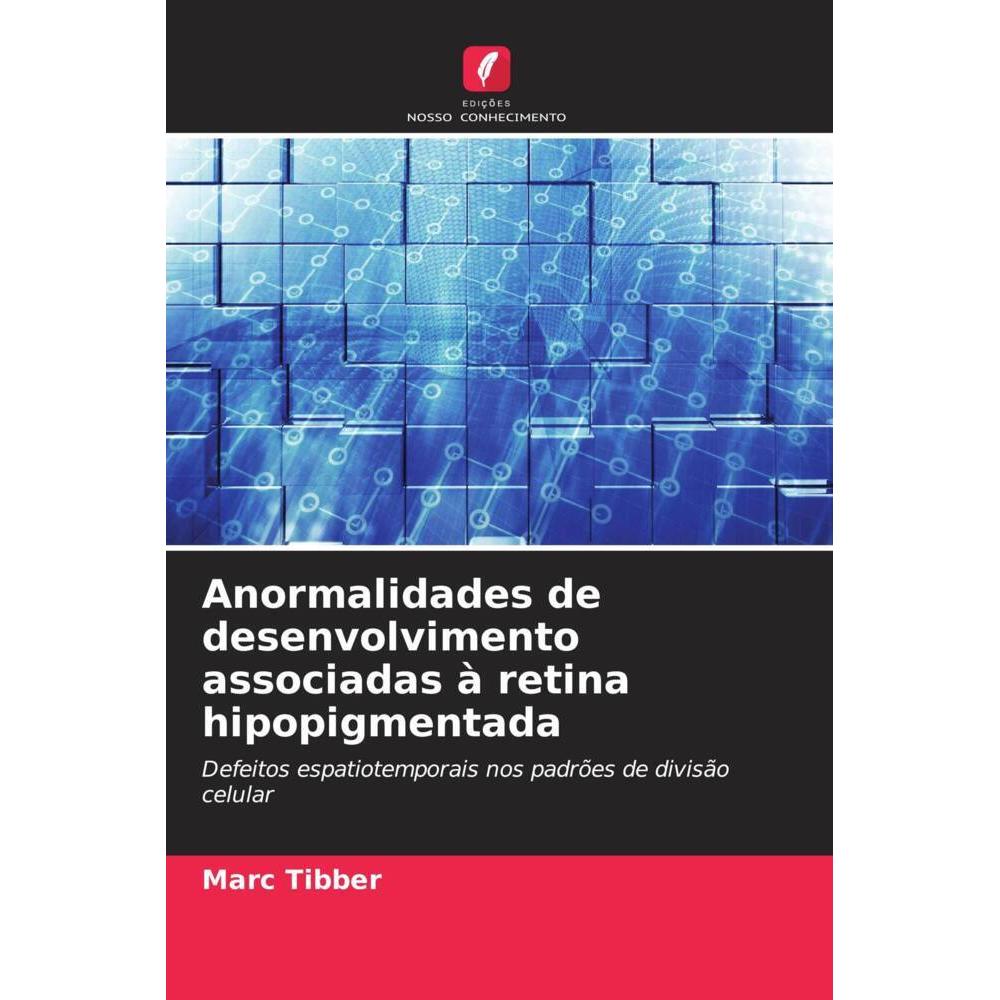Anormalidades de desenvolvimento associadas à retina hipopigmentada, Fachbücher von Marc Tibber