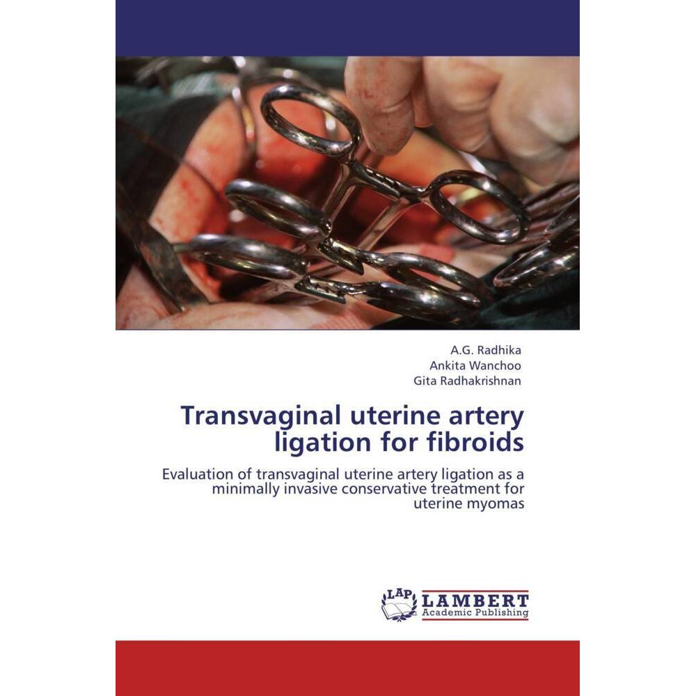 Transvaginal uterine artery ligation for fibroids, Fachbücher