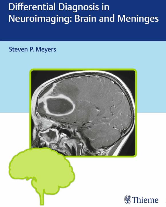 Produktbild Differential Diagnosis in Neuroimaging: Brain and Meninges (Englisch, Steven P. Meyers, 2016)