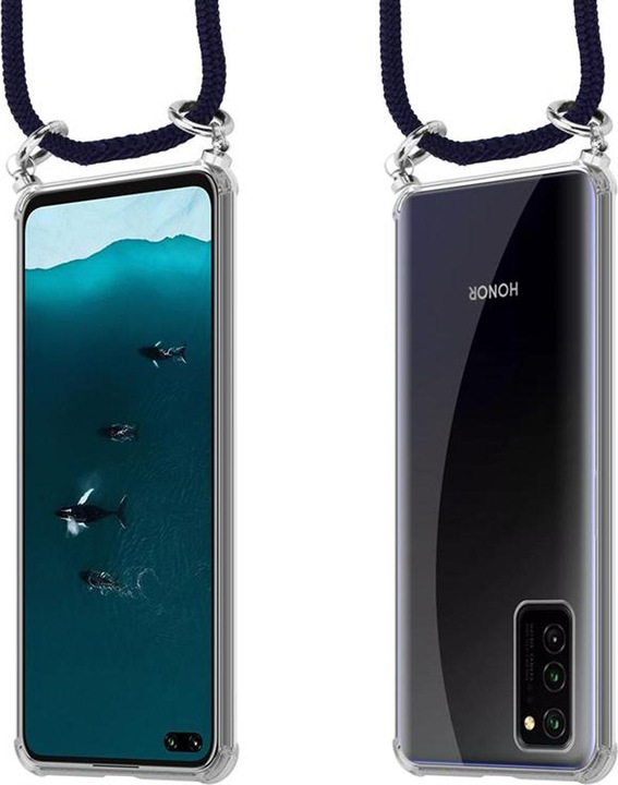 Produktbild Cadorabo TPU Handy Kette SILBER Cover