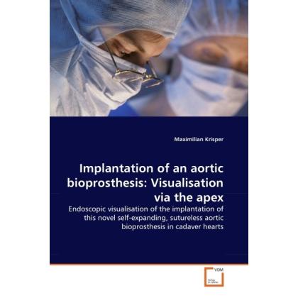 Implantation of an aortic bioprosthesis: Visualisation via the apex, Fachbücher