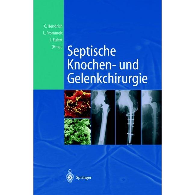 Septische Knochen-und Gelenkchirurgie, Fachbücher