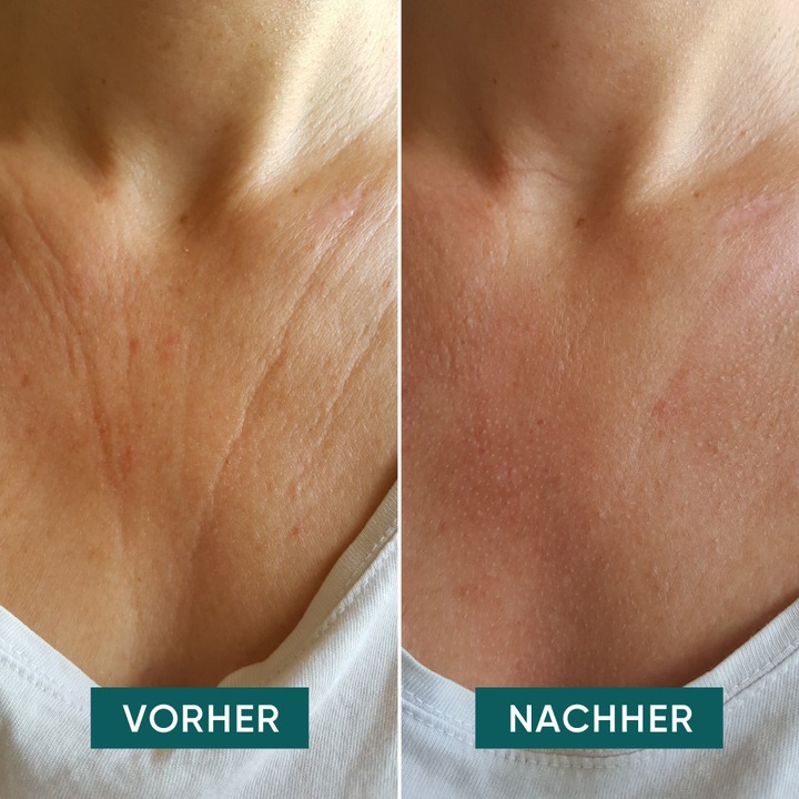 Produktbild Apricot wiederv. Dekolleté Pads Vitamin C „Dekolleté delight“