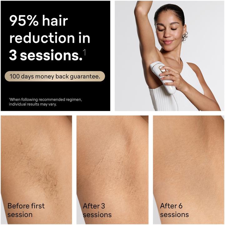 Actual product image Braun Silk·expert Pro 5