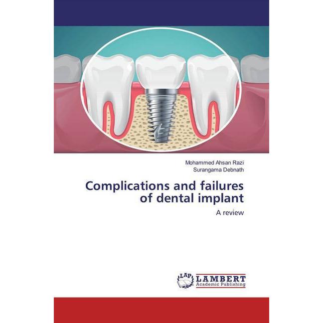 Complications and failures of dental implant, Fachbücher von Surangama Debnath, Mohammed Ahsan Razi