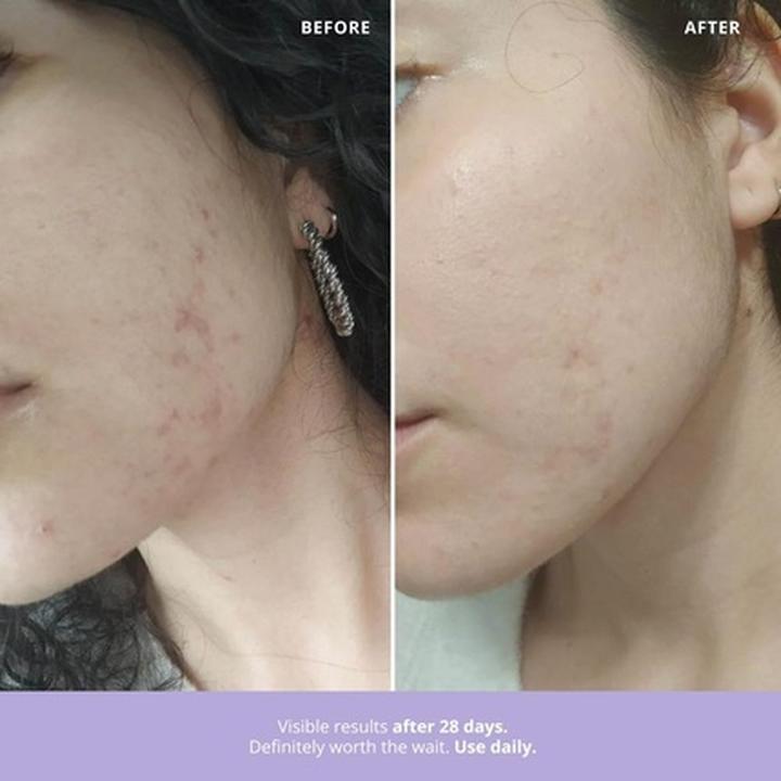 Actual product image Freshly Cosmetics Azelaic Radiance (50 ml)