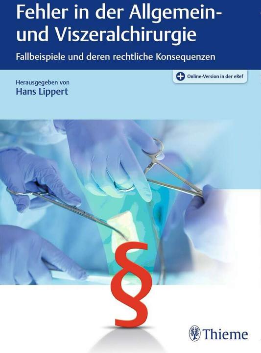 Produktbild Fehler in der Allgemein- und Viszeralchirurgie (Deutsch, Hans Lippert, 2017)
