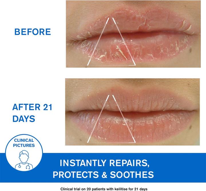 Productafbeelding Uriage DS Regulerende Verzorgende Emulsie (40 ml, 24h crème)