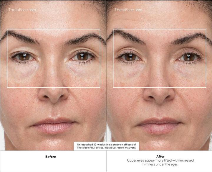 Produktbild Therabody TheraFace PRO, schwarz