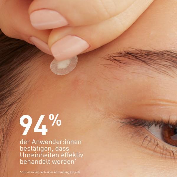 Actual product image CeraVe Anti-Unreinheiten Patches (Cleansing lotion)