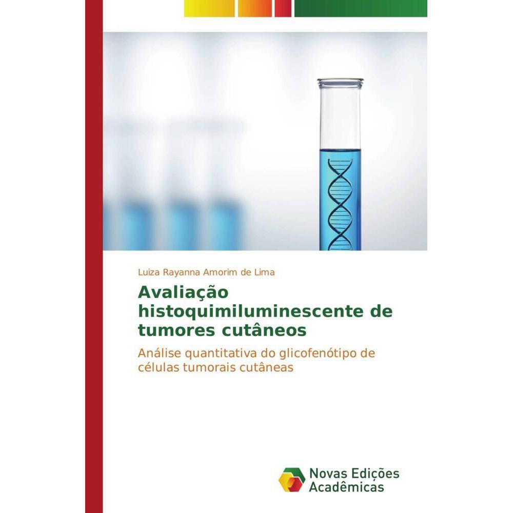 Avaliação histoquimiluminescente de tumores cutâneos, Fachbücher von Luiza Rayanna Amorim de Lima