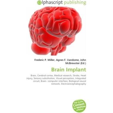 Brain Implant, Fachbücher von Agnes F. Vandome, Frederic P. Miller, John McBrewster
