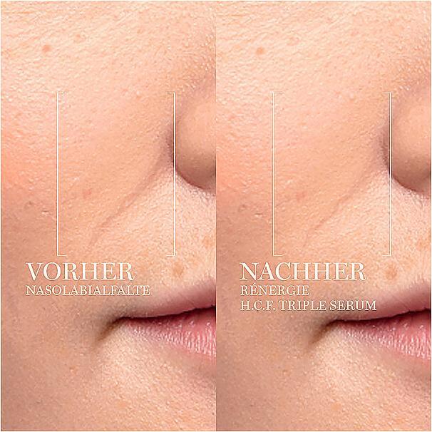 Produktbild Lancôme Rénergie Triple Serum (50 ml)