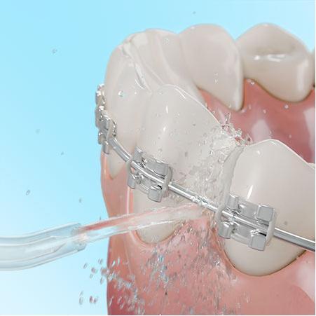 Produktbild Cecotec 04315