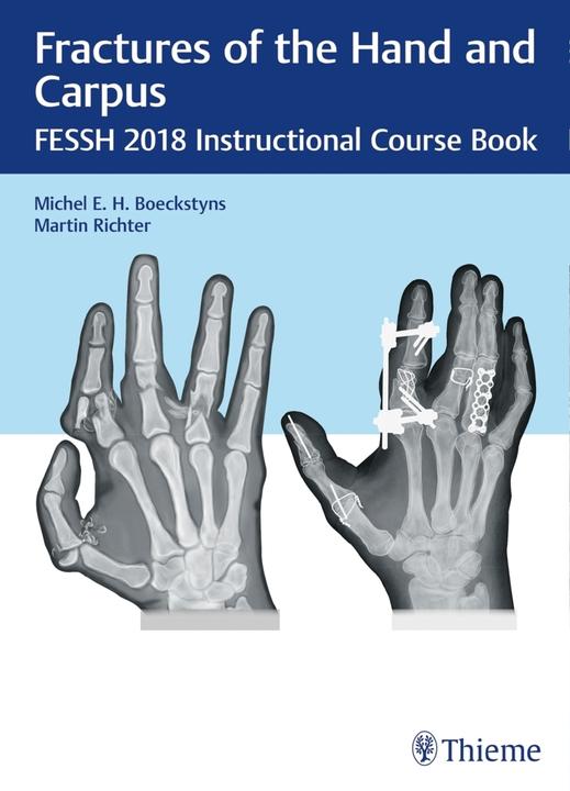 Produktbild Fractures of the Hand and Carpus (Englisch, Martin Richter, Michel E.H. Boeckstyns, 2018)