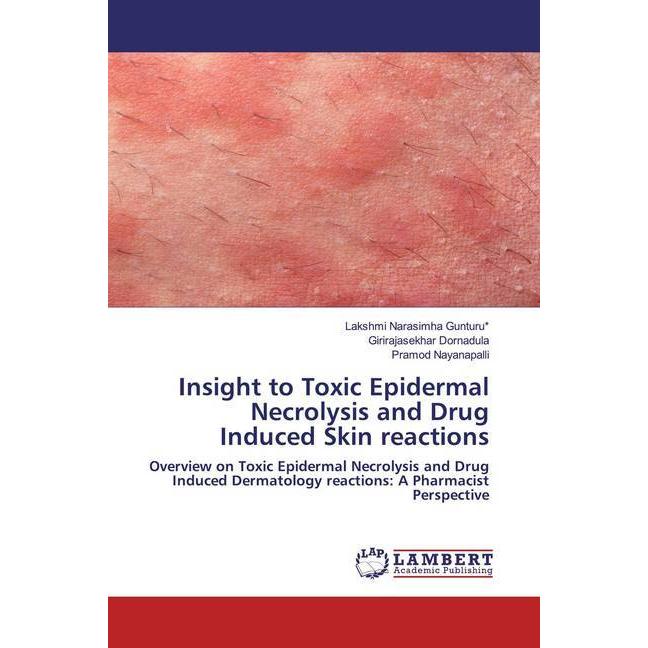 Insight to Toxic Epidermal Necrolysis and Drug Induced Skin reactions, Fachbücher von Lakshmi Narasimha Gunturu, Giriraj...