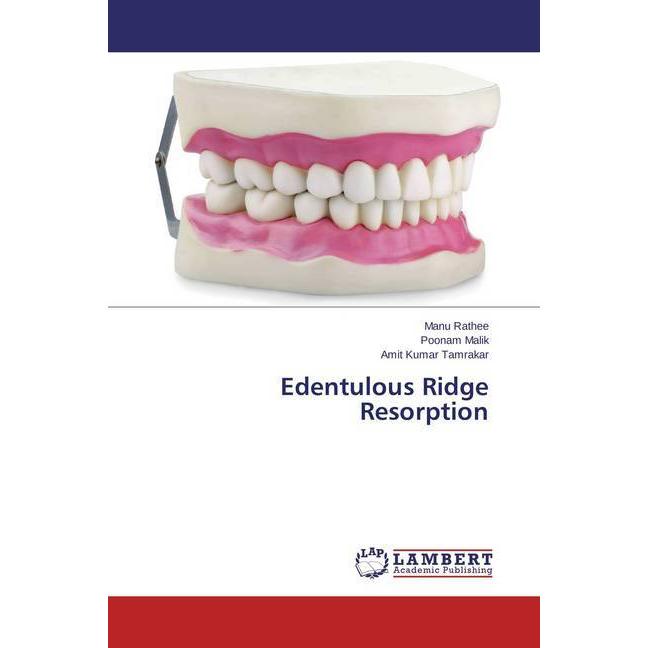 Thumbnail - Edentulous Ridge Resorption, Ratgeber von Manu Rathee, Poonam Malik, Amit Kumar Tamrakar