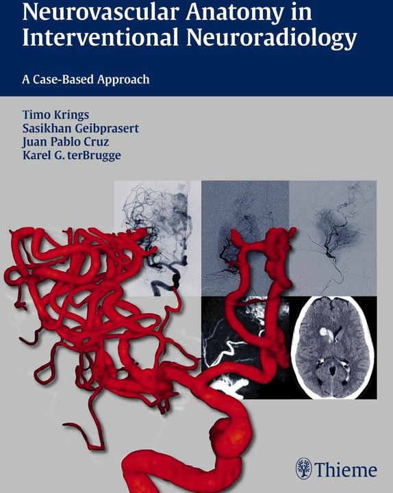 Produktbild Neurovascular Anatomy in Interventional Neuroradiology (Englisch, Juan Pablo Cruz, Sasikhan Geibprasert, Timo Krings, 2015)
