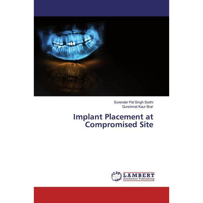 Implant Placement at Compromised Site, Fachbücher von Gursimrat Kaur Brar, Surender Pal Singh Sodhi