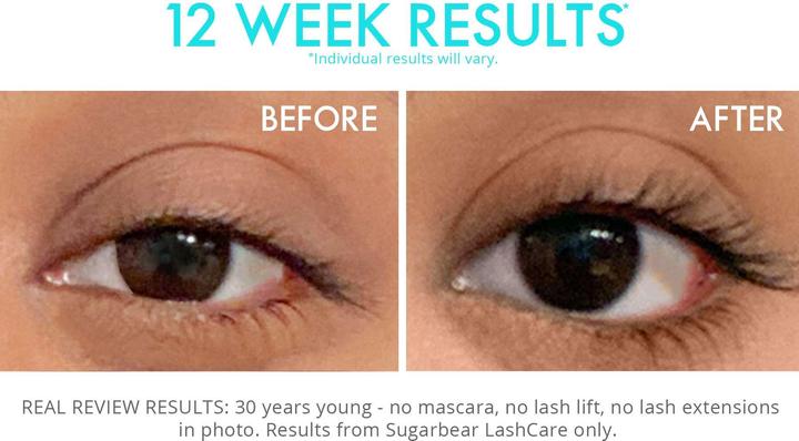 Immagine prodotto Sugarbearhair - Siero vitaminico Lashcare (3 ml)