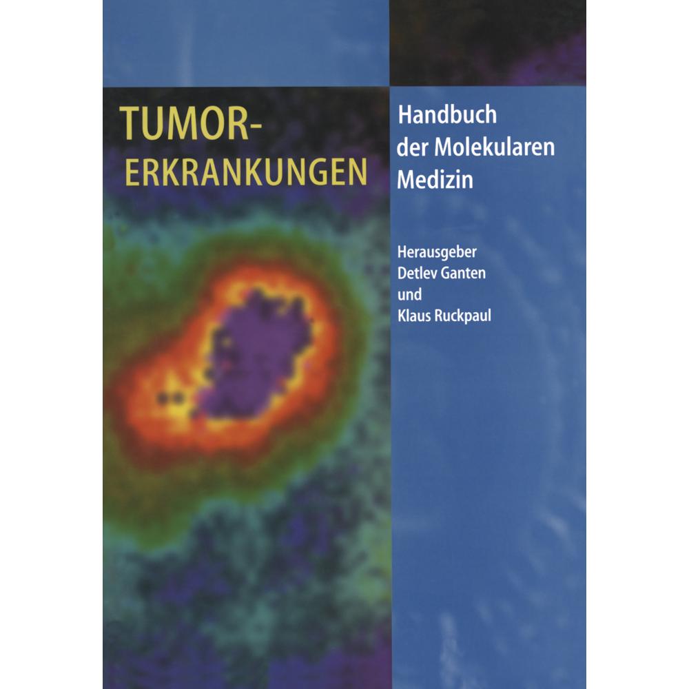 Tumorerkrankungen, Fachbücher von Detlev Ganten, Klaus Ruckpaul