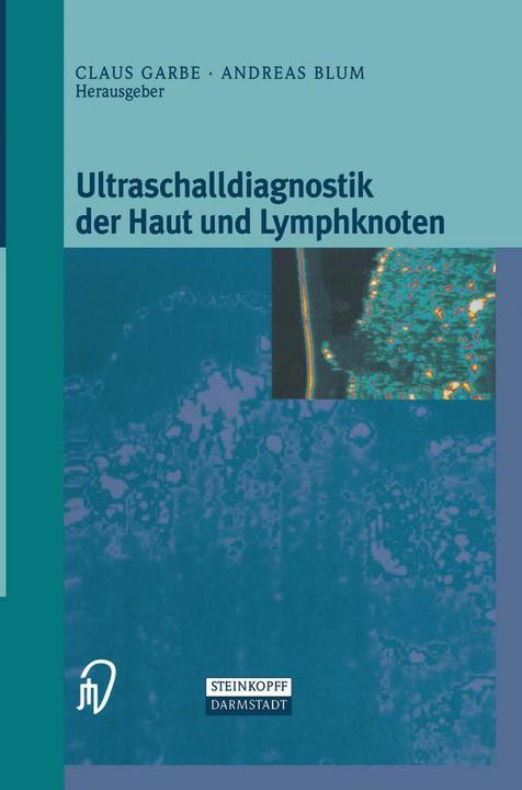 Produktbild Ultraschalldiagnostik der Haut und Lymphknoten (Deutsch, Andreas Blum, Klaus Garbe, 2013)