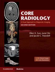 Actual product image Core Radiology (English, Jacob C. Mandell, Ellen X. Sun, Junzi Shi, 2021)