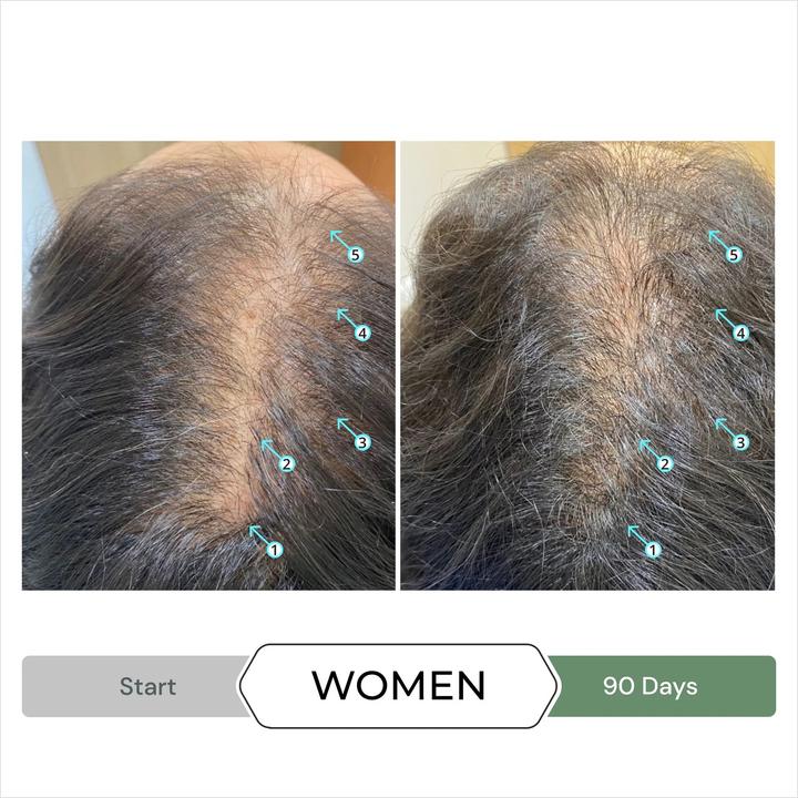 Produktbild DS Laboratories Revita Cbd Hair Stimulating Shampoo - 205ml (Flüssiges Shampoo, 205 ml)