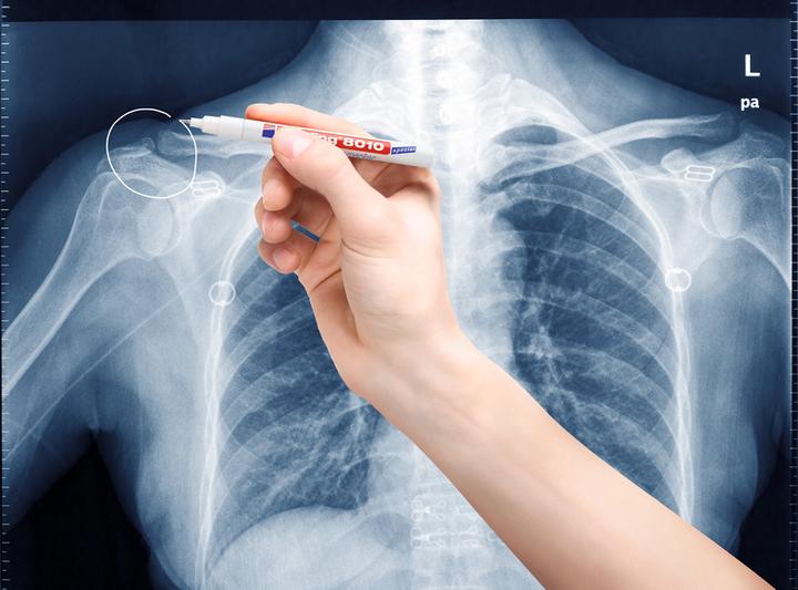 Actual product image Edding X-ray marker 8010 (White, 0.80 mm, 1 x)