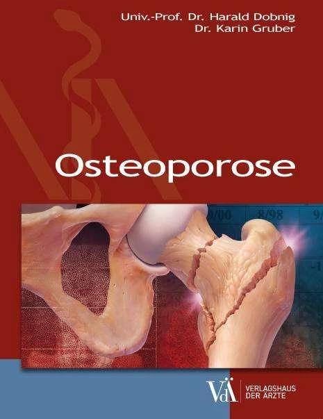 Produktbild Osteoporose (Deutsch, Harald Dobnig, Karin Gruber, 2016)