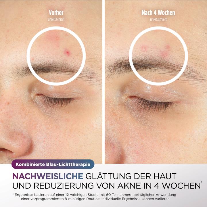 Produktbild Shark CryoGlow LED-Maske + FW312EUPL