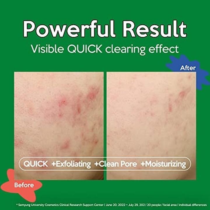 Image du produit Trouble Troubless Clear Toner Pad for Face Gentle Peeling and Facial Soothing (Tonique visage)