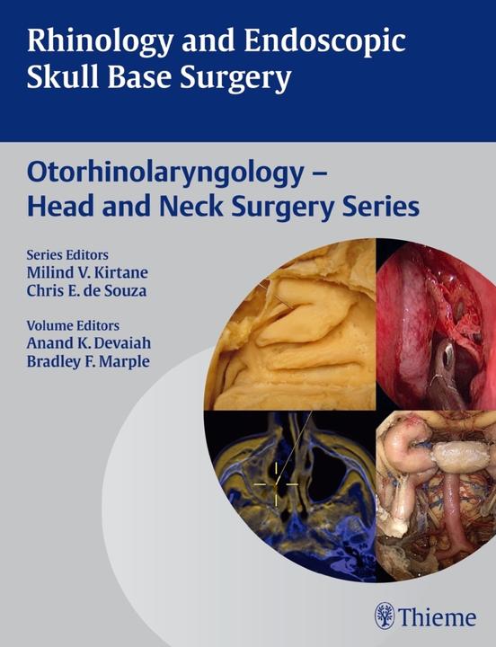 Produktbild Rhinology and Endoscopic Skull Base Surgery (Englisch, 2013)