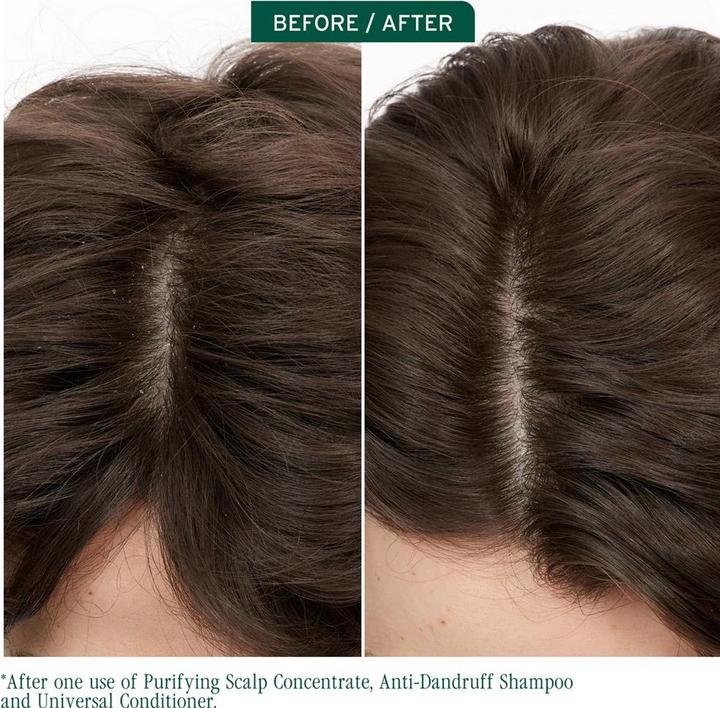 Actual product image Biolage Conditioner for All Scalp Types (200 ml)