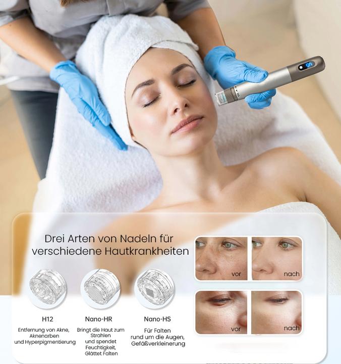 Image du produit Beautifly SkinRenew Pro Dermapen