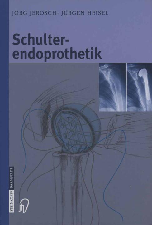 Produktbild Schulterendoprothetik (Deutsch, Jörg Jerosch, Jürgen Heisel, 2012)