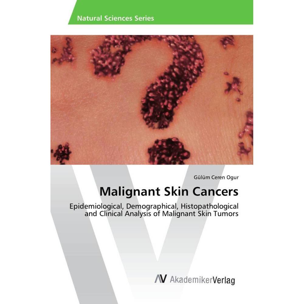 Malignant Skin Cancers, Fachbücher von Gülüm Ceren Ogur
