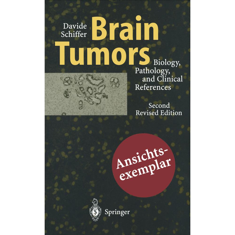 Thumbnail - Brain Tumors, Fachbücher von Davide Schiffer