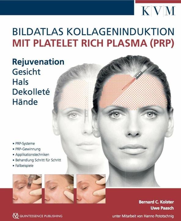 Produktbild Bildatlas Platelet Rich Plasma (PRP) (Deutsch, Bernard C. Kolster, Uwe Paasch, 2018)