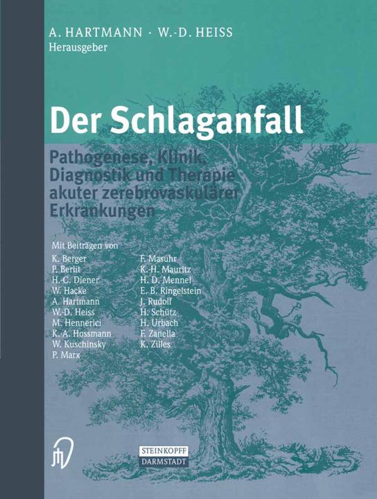 Produktbild Der Schlaganfall (Deutsch, 2012)