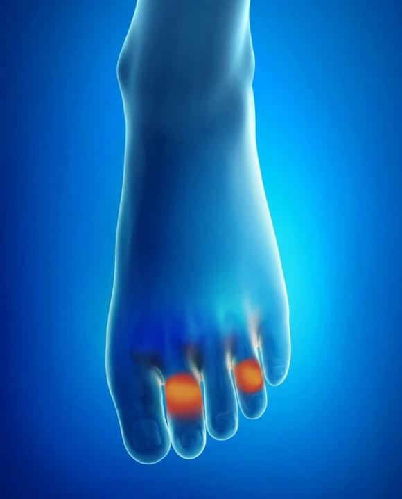 Actual product image Epitact Digitubes S 1 Pc (Toe separators)