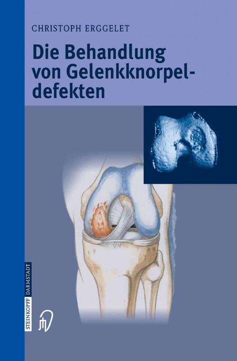 Produktbild Die Behandlung von Gelenkknorpeldefekten (Deutsch, Christoph Erggelet, 2014)