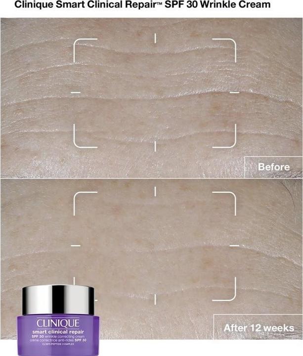 Actual product image Clinique Smart - Clinical Repair Wrinkle Correcting Cream SPF30 (75 ml, Day cream, SPF 30)