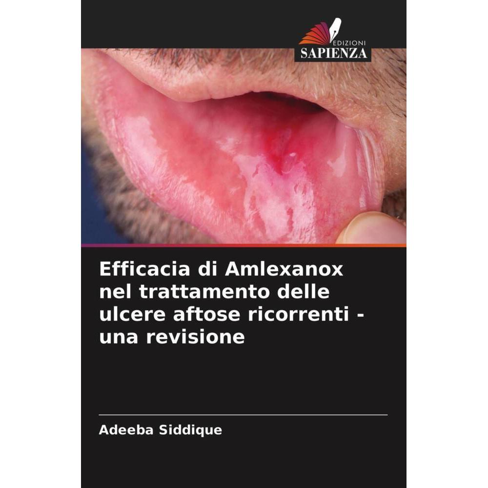 Efficacia di Amlexanox nel trattamento delle ulcere aftose ricorrenti - una revisione, Fachbücher von Adeeba siddique