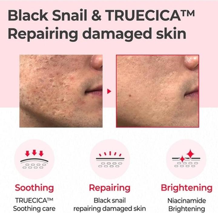 Actual product image Some By Mi Snail Truecica Miracle Repair (135 ml)