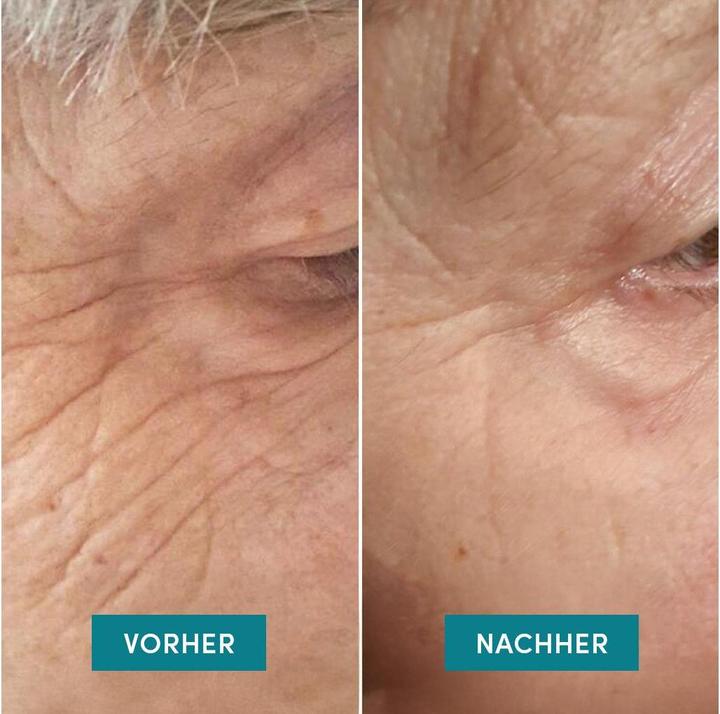 Actual product image Apricot Eyes & Temple