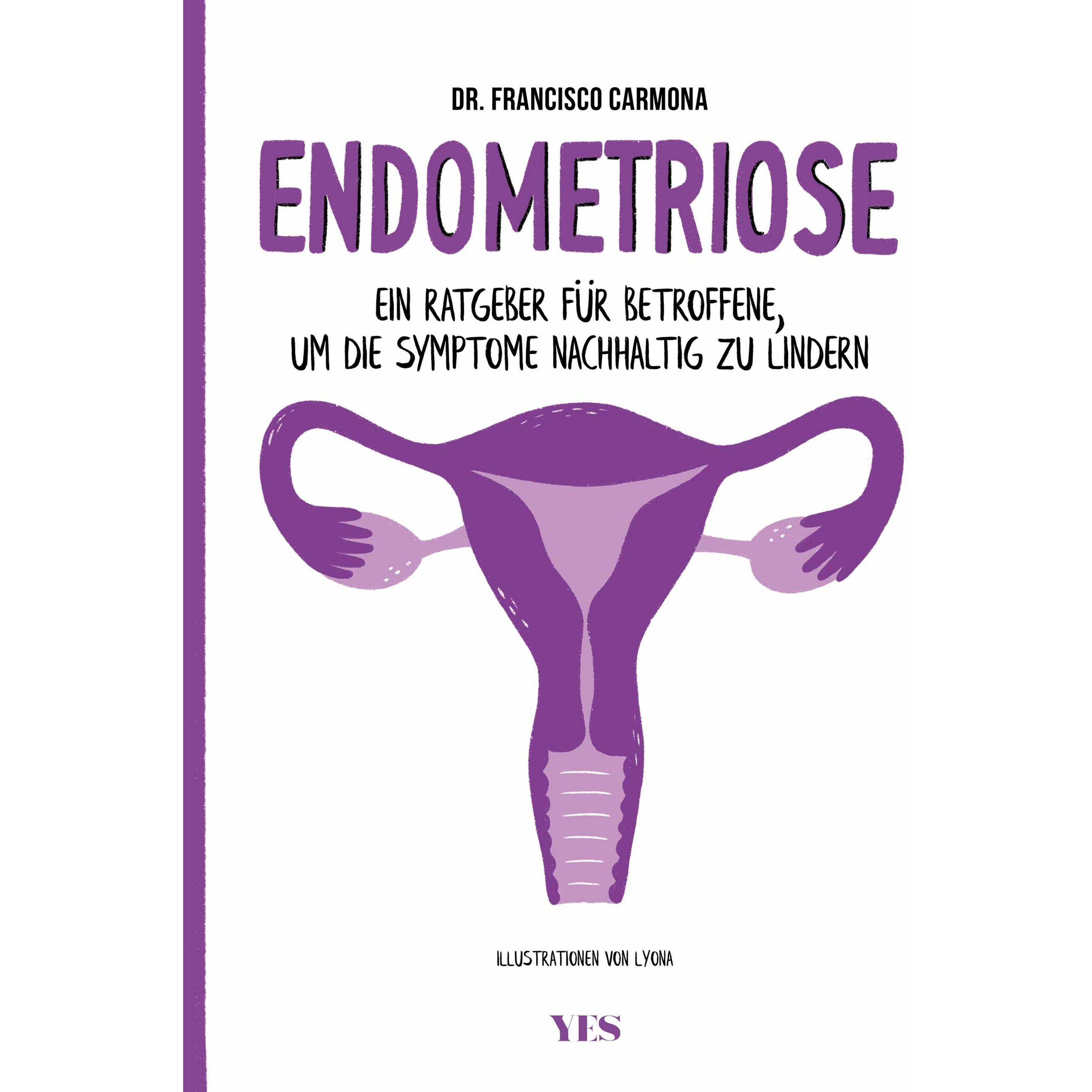Endometriose, Ratgeber von Francisco Carmona, Marta Puig